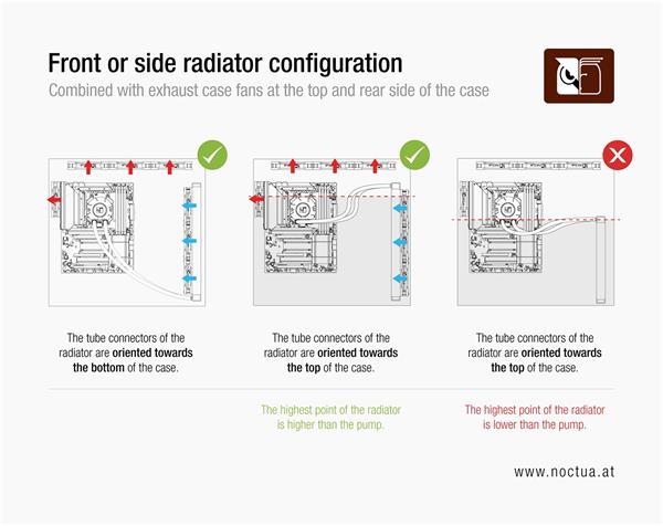 Noctua NL-LC1-24 AIO chladič CPU 240mm