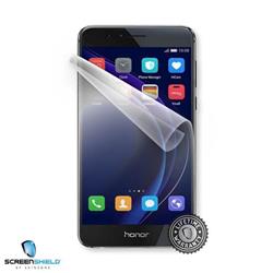 ScreenShield Huawei HONOR 8 - Film for display protection